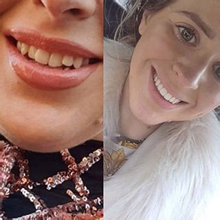 teeth whitening leatherhead|mydentist High Street, Leatherhead .